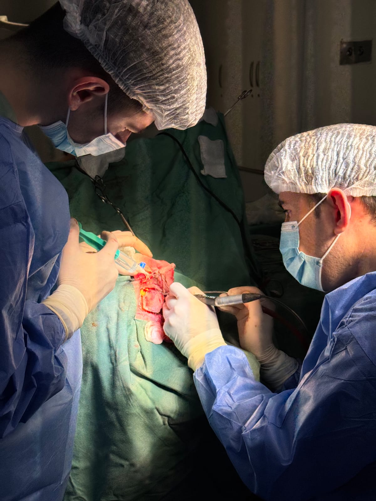 AEOS sistemi Azərbaycana ilk dəfə Medsol MMC tərəfindən gətirildi və Respublika Neyrocərrahiyyə Xəstəxanasında istifadəyə verildi. Yeni qurğu sayəsində artıq ilk əməliyyat uğurla həyata keçirildi. image 12