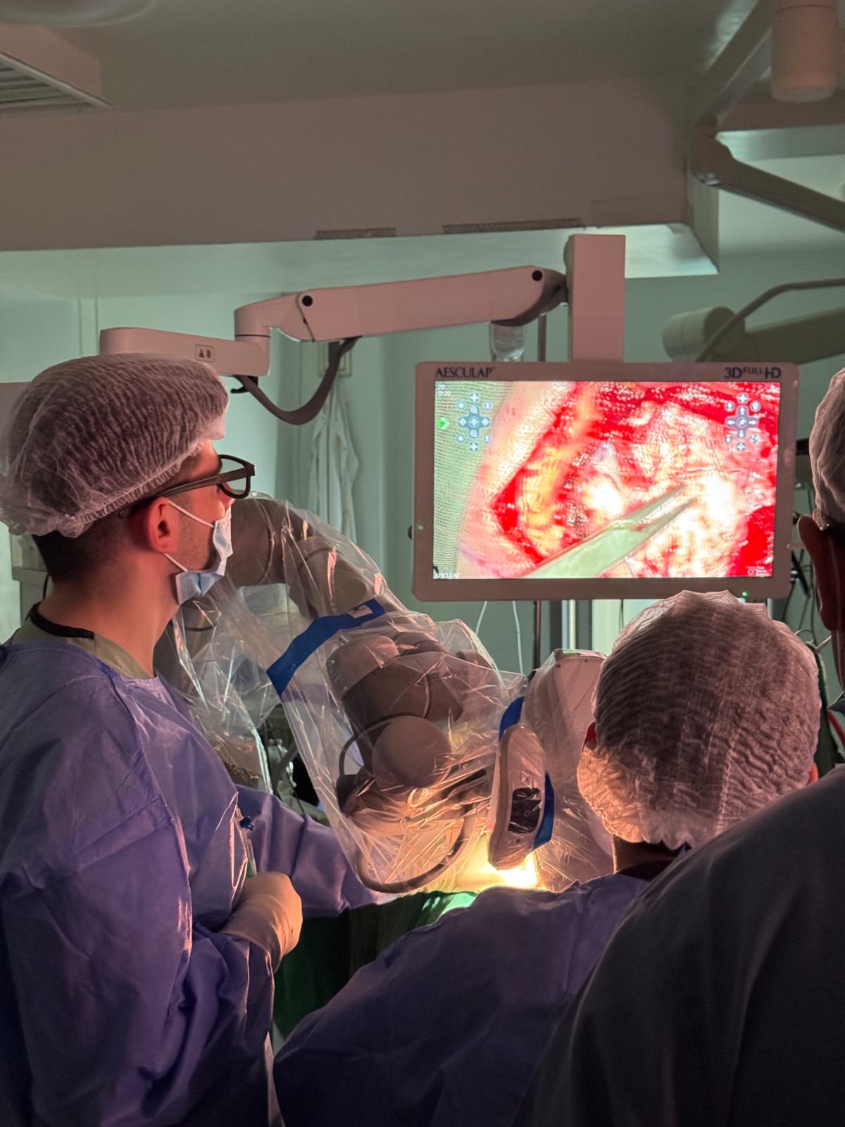 AEOS sistemi Azərbaycana ilk dəfə Medsol MMC tərəfindən gətirildi və Respublika Neyrocərrahiyyə Xəstəxanasında istifadəyə verildi. Yeni qurğu sayəsində artıq ilk əməliyyat uğurla həyata keçirildi. image 16