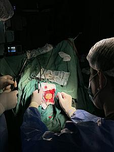 AEOS sistemi Azərbaycana ilk dəfə Medsol MMC tərəfindən gətirildi və Respublika Neyrocərrahiyyə Xəstəxanasında istifadəyə verildi. Yeni qurğu sayəsində artıq ilk əməliyyat uğurla həyata keçirildi. thumbnail 17